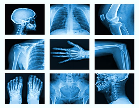 X-Ray in Karnataka